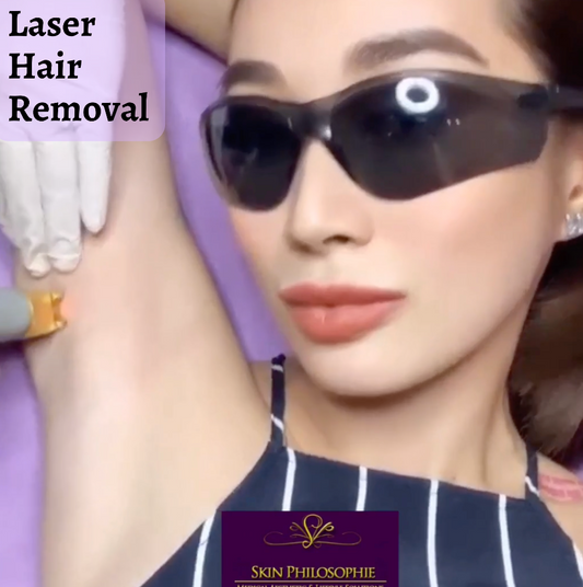 Laser Hair Removal for the Underarms (1 session)
