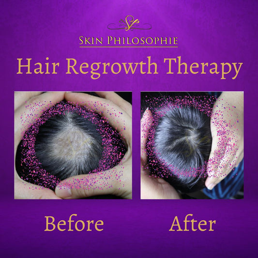 Hair Regrowth Therapy (1 session)